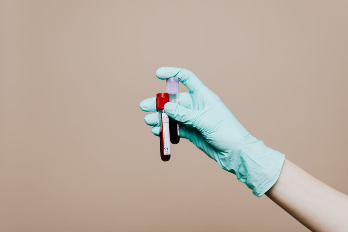A gloved hand holding a blood sample tube